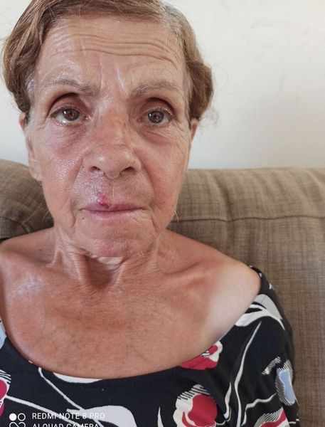 Βρέθηκε νεκρή η 70χρονη Βαρβάρα στη Λεμεσό