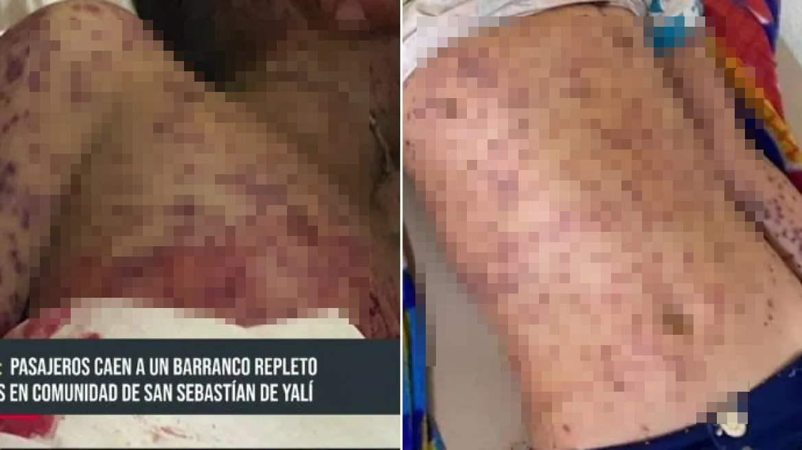 Σοκαριστικό βίντεο