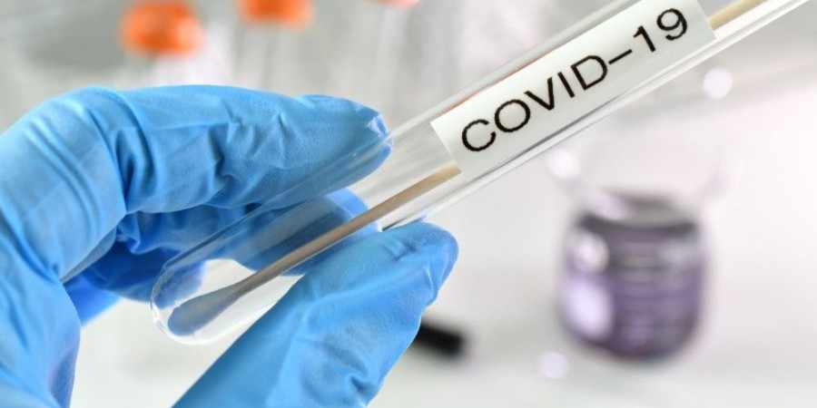 Υπάλληλος έδειξε πλαστό rapid test και συνελήφθη