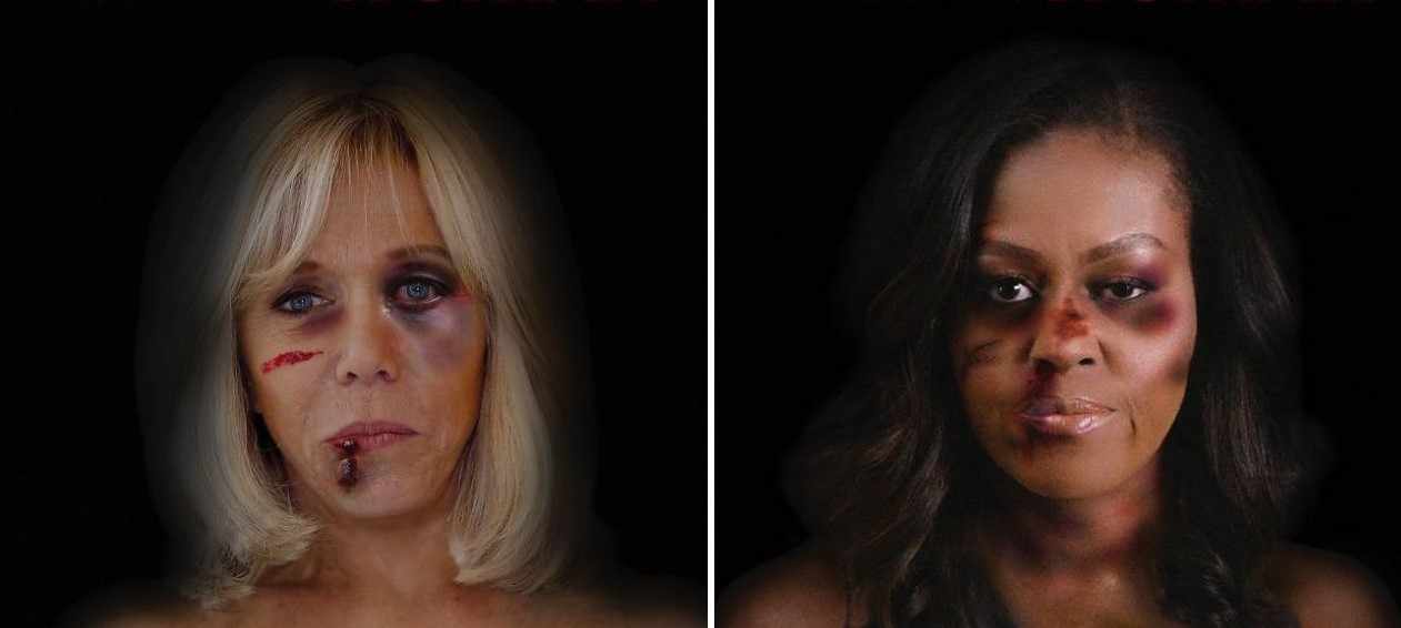 Μπριζίτ Μακρόν και Μισέλ Ομπάμα με μώλωπες στο πρόσωπο