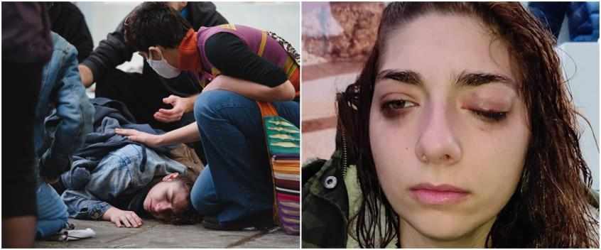 Σε επέμβαση η 25χρονη Αναστασία