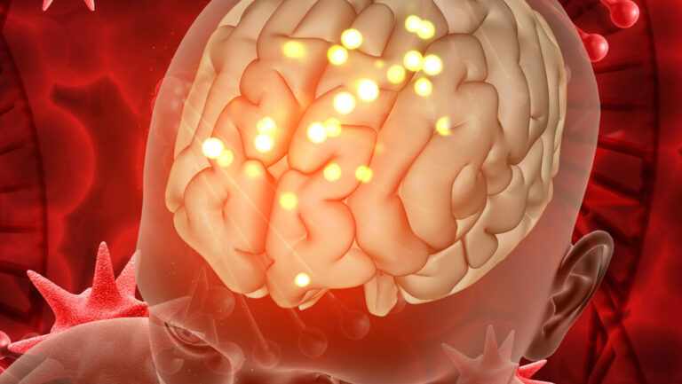 Επιτυχές το πρώτο εμφύτευμα για αντιμετώπιση επιληπτικών κρίσεων στη Βρετανία