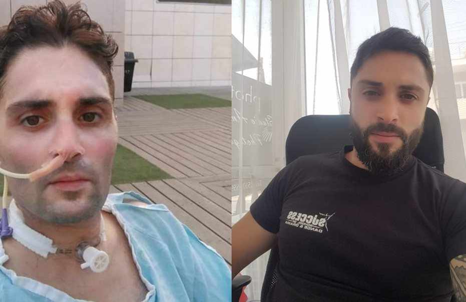 «Κάηκε όλο μου το σώμα…Φώναζα με όση δύναμη μου είχε απομείνει
