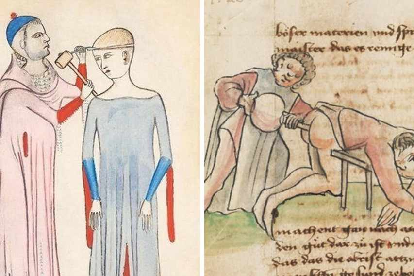 10 απίθανες ηλιθιότητες που ήταν καθημερινότητα στο Μεσαίωνα