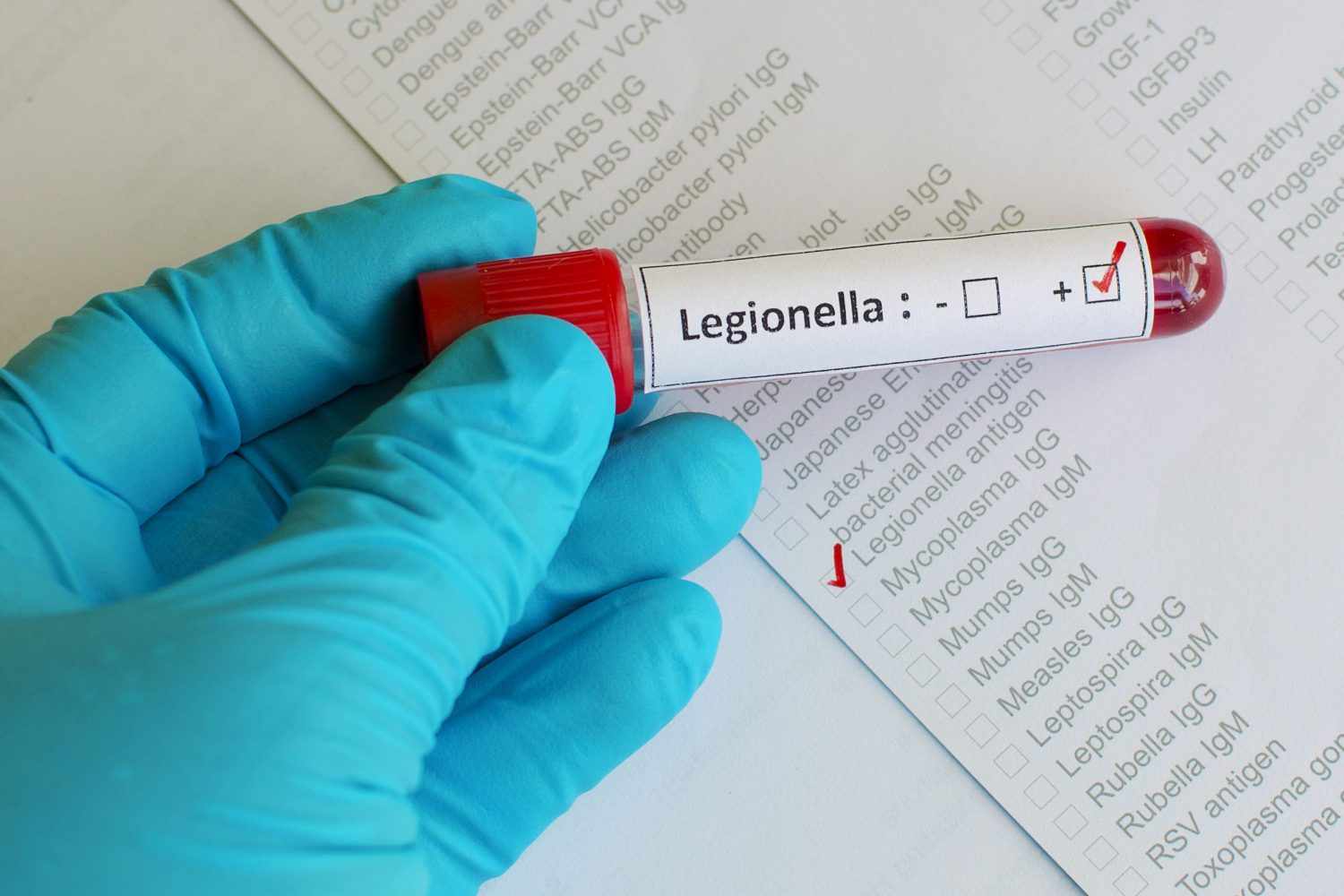 Legionnaire Disease 