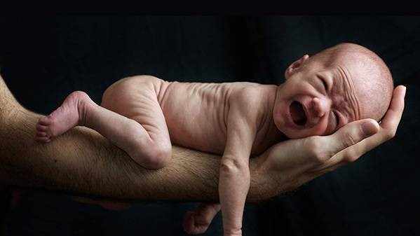 Παγκόσμια ημέρα προωρότητας