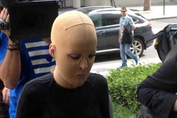 Της έριξε εύφλεκτο υλικό από τη ζήλια. Δύο χρόνια μετά, βγάζει τη μάσκα και δείχνει το νέο της πρόσωπο