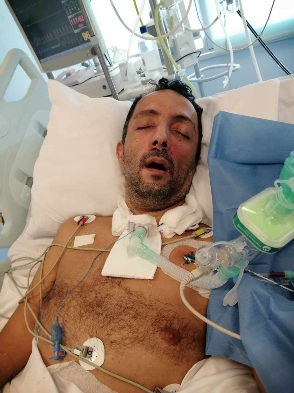 Το ατύχημα στο σαλόνι του σπιτιού του που… του άλλαξε εντελώς τη ζωή