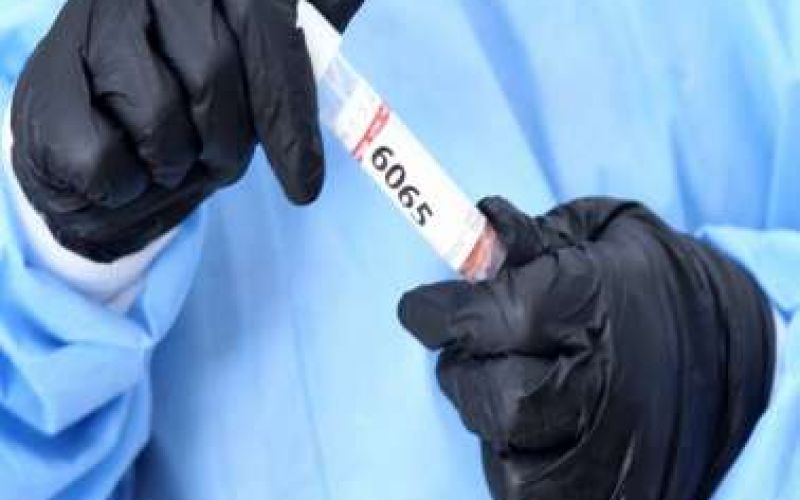 152 νέα κρούσματα - 11 από rapid tests