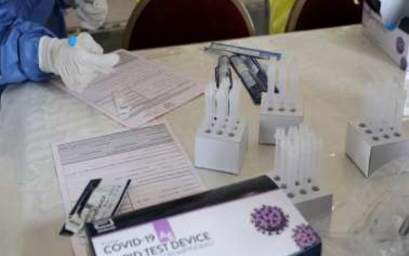Rapid test αύριο για εργαζόμενους